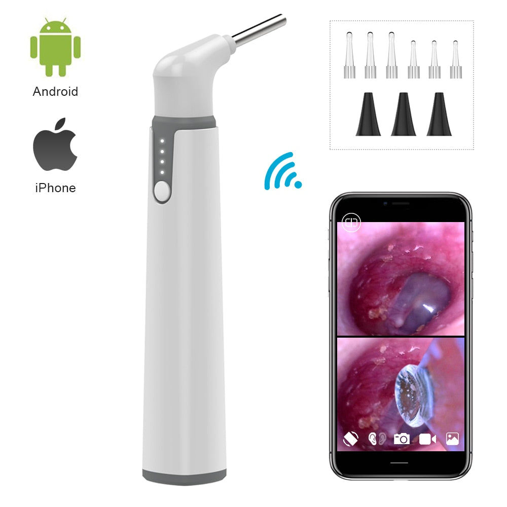 Wifi Ear Otoscope 3.9mm Smart Wireless Portable Visual Earwax Cleaning Medical Endoscope Camera for iPhone Android Phone 0.01