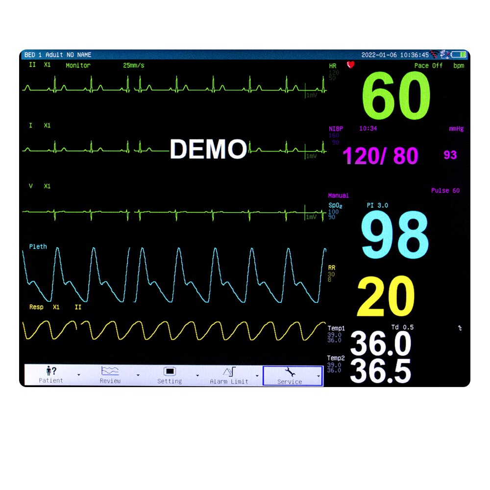 15 Inch Portable Vital Signs Veterinary Patient Monitor for Parameter Clinic Monitor Equipment